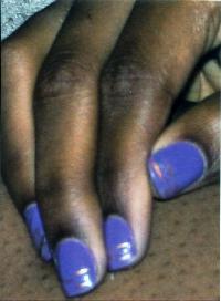 Victim Photo 1